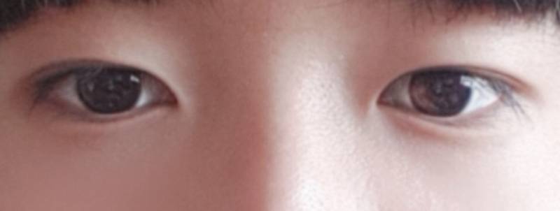 자연쌍코풀 있는사람 ㅜㅜㅜㅜ | 인스티즈