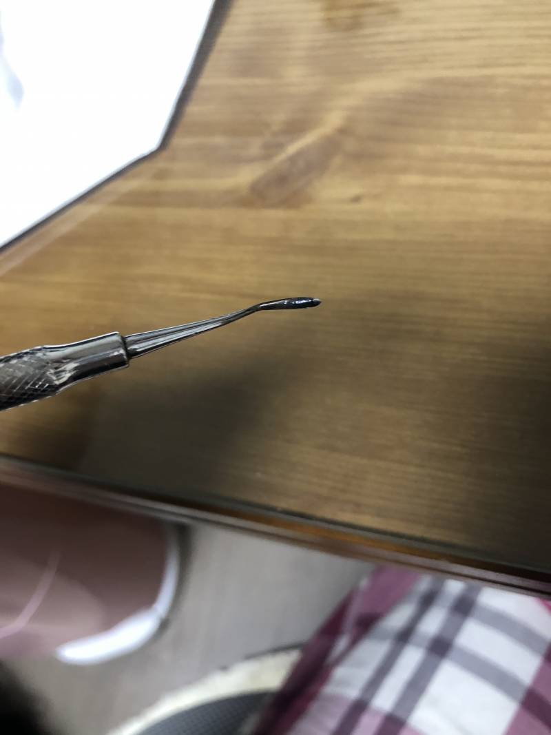 나 여기에 긁혀서 이 정도 상처났는데 파상풍 주사 안 맞아도 되겠지? | 인스티즈