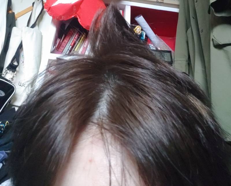 와 자고일어나니까 머리 이리됌 | 인스티즈