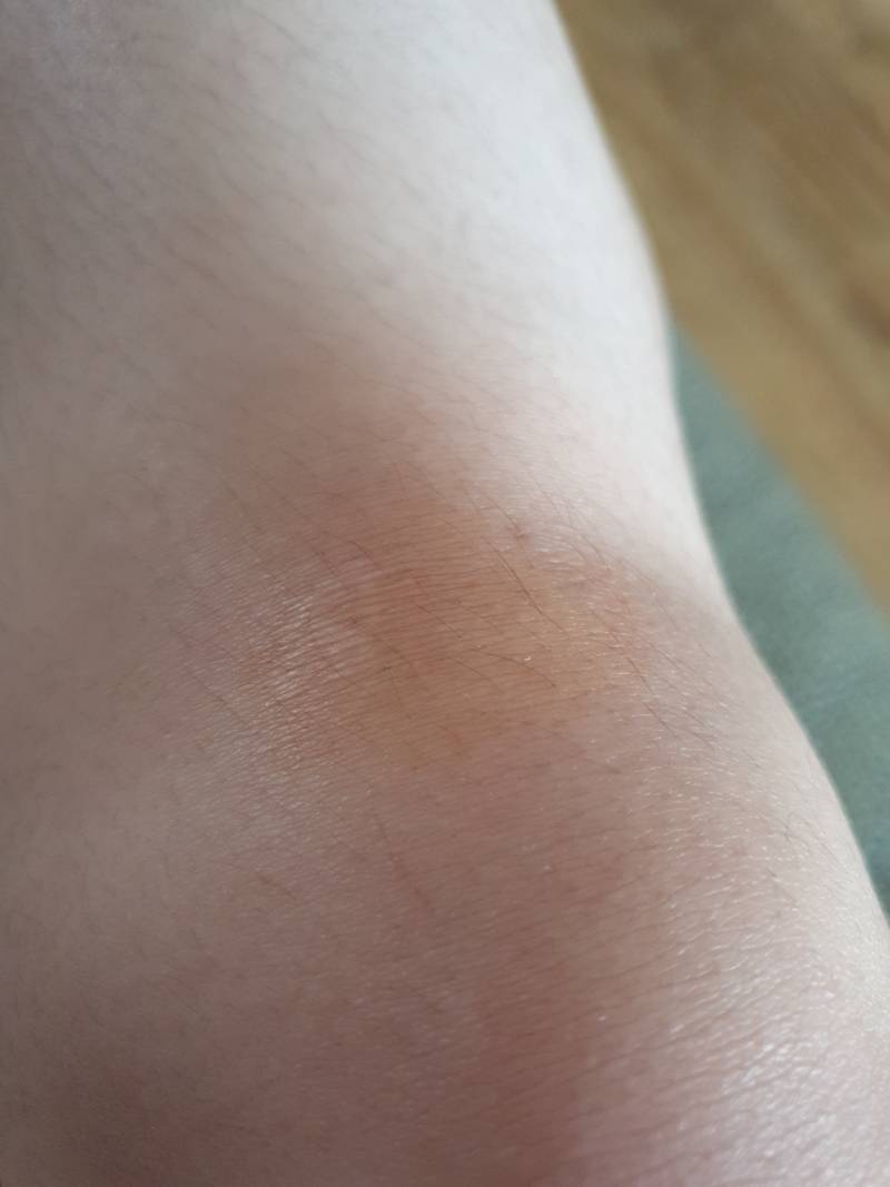 무릎에 김치 양념 묻었는데 주황색으로 물들어버림ㅋㅋㅋㅋㅋㅋㅋㅋㅋㅋㅋ | 인스티즈