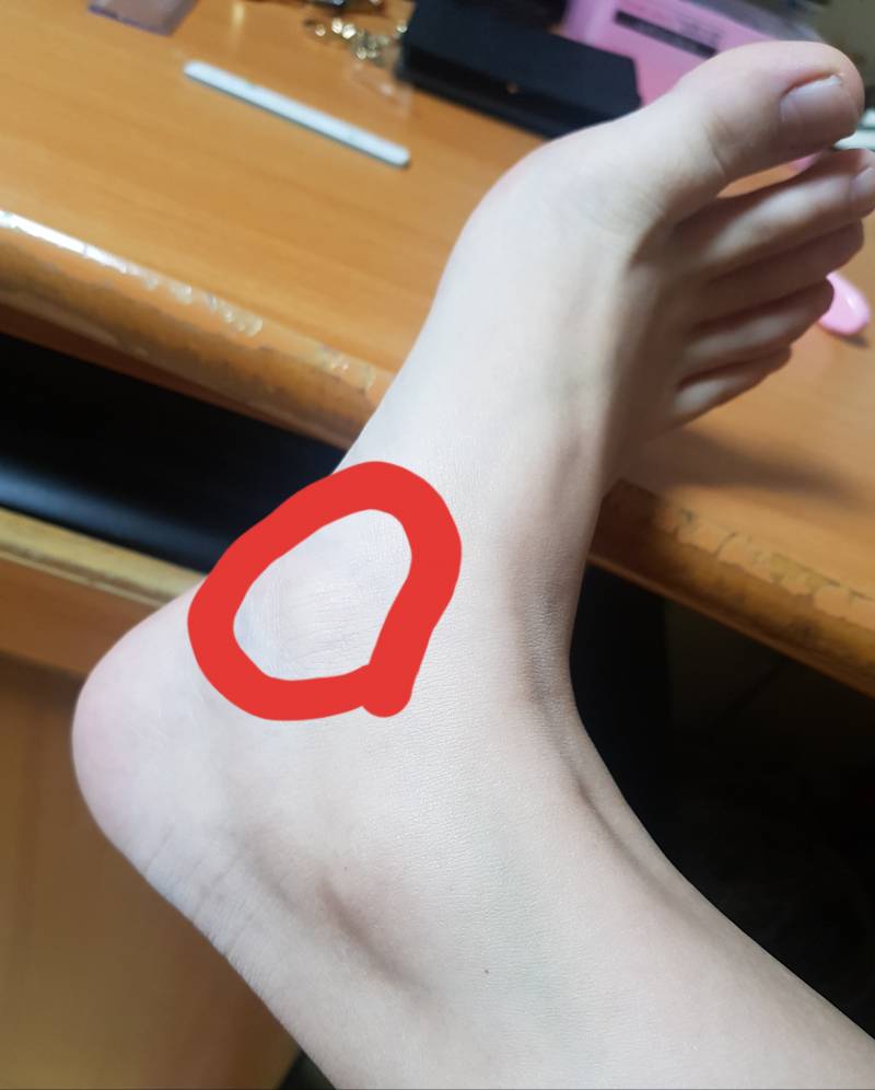 다들 발에 이 부분 튀어나와있니??(발사진주의) | 인스티즈