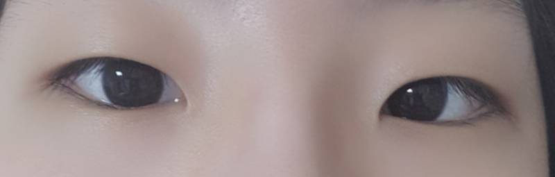 나 안검하수야?? | 인스티즈