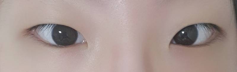 나 안검하수야?? | 인스티즈