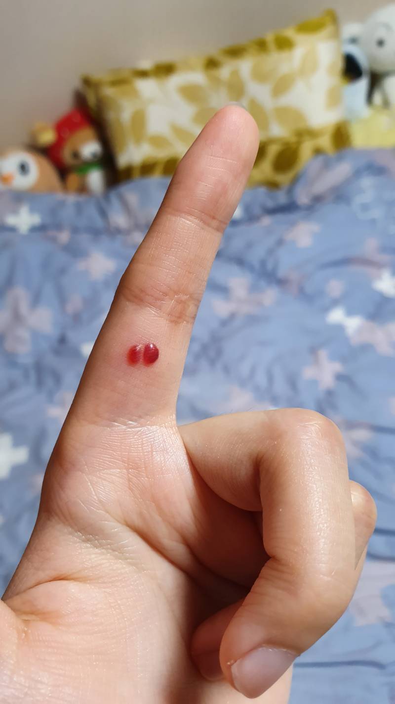 이거 그냥 내비둬도 되지? ㅠ ㅠ ㅠ | 인스티즈