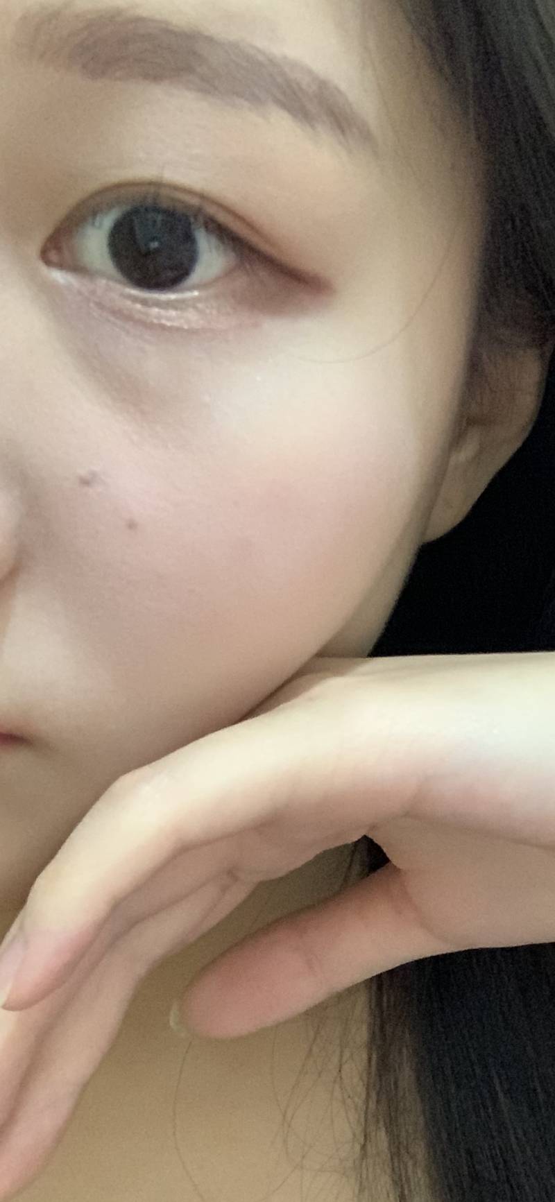 내 눈 아래 애굣살?? 부분에 주름같은거 왜 그런지 아는 사람...404040 | 인스티즈