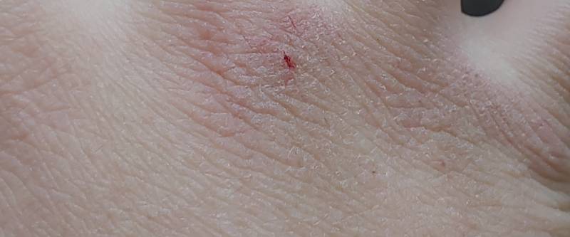 나이거 핸드크림 안발라서 이런거야? | 인스티즈