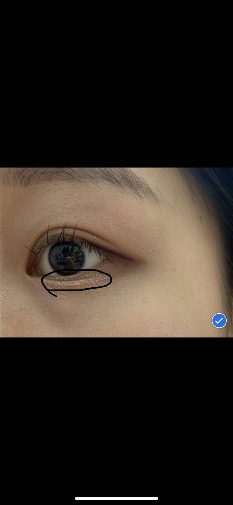 내 눈 아래 애굣살?? 부분에 주름같은거 왜 그런지 아는 사람...404040 | 인스티즈