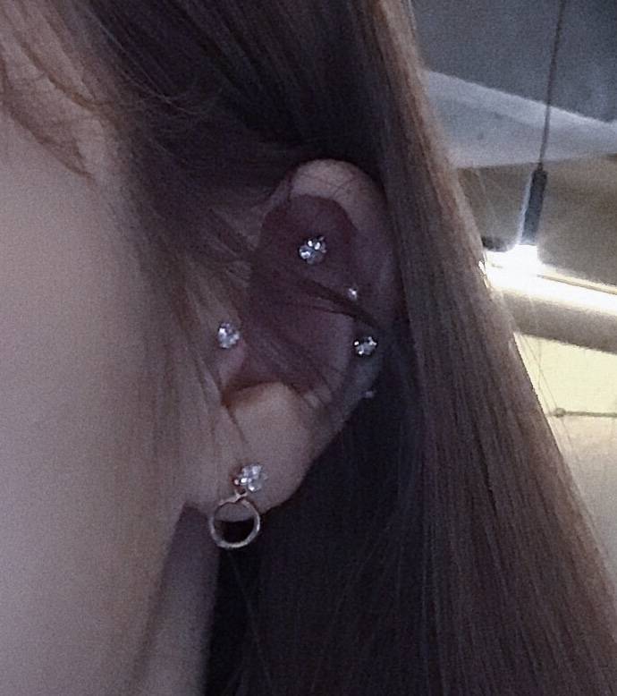 나 귀 너무 징그러운거 같아ㅠㅠㅠㅠㅠ (사진주의 | 인스티즈