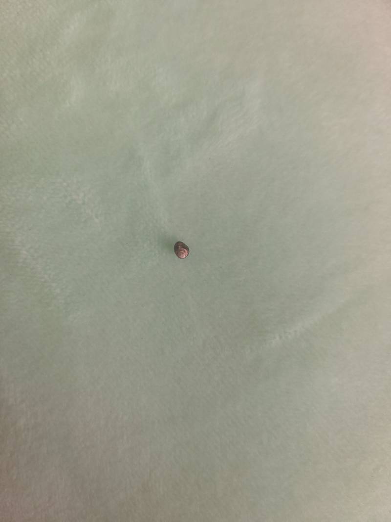 와씨..등에서 대박적인거 빾다...ㅎㅇㅈㅇ | 인스티즈