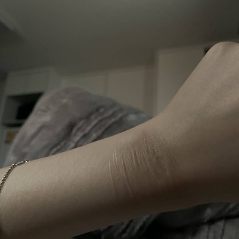 자해하면 손목 흉터 남는다는 글 보고 | 인스티즈