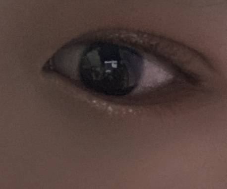 쌍수 어때 잘 된거 같아 ..? | 인스티즈