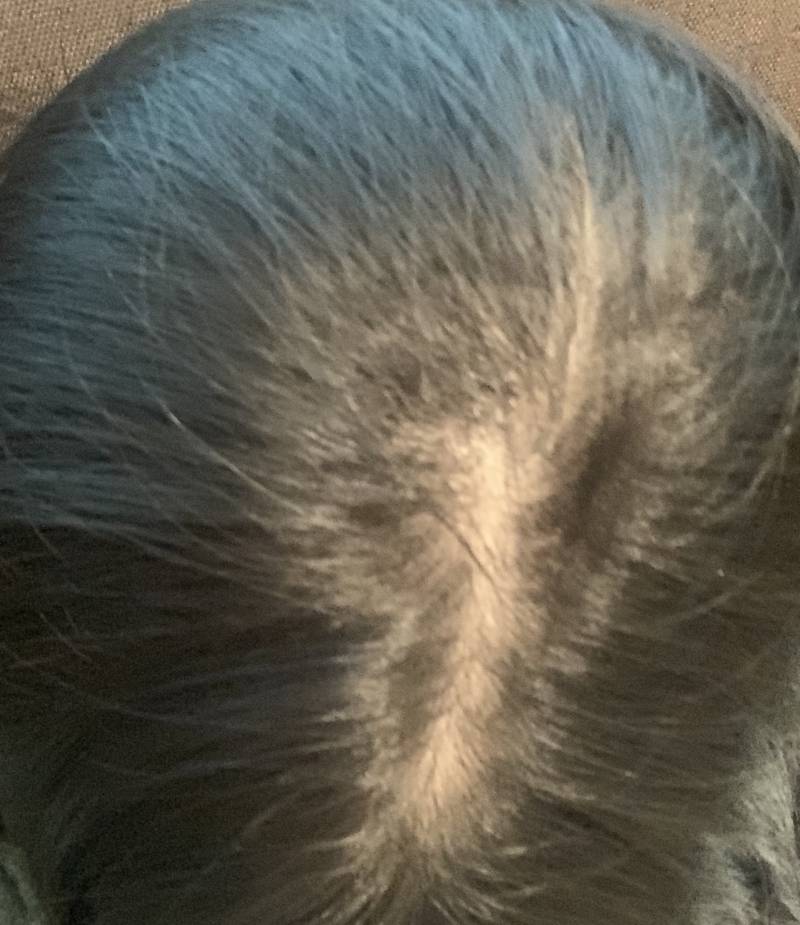 나 정수리 엄청 많이 비어보여...40 | 인스티즈