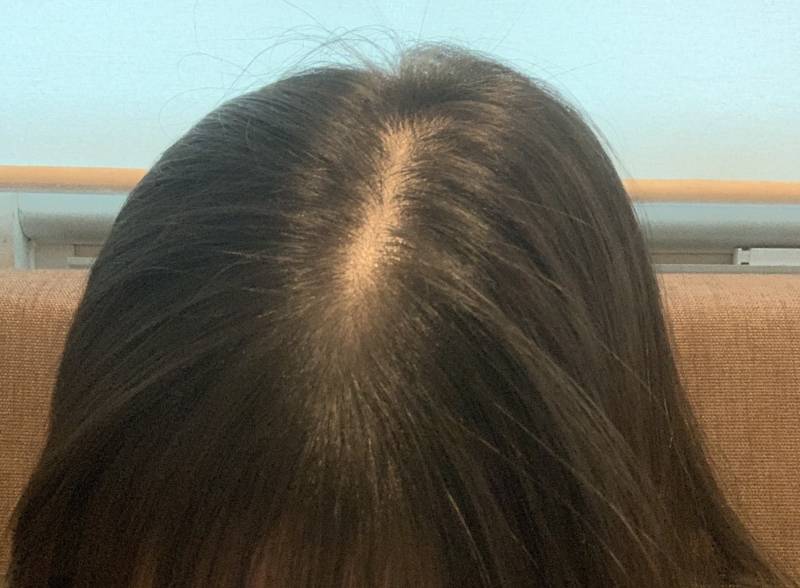 나 정수리 엄청 많이 비어보여...40 | 인스티즈