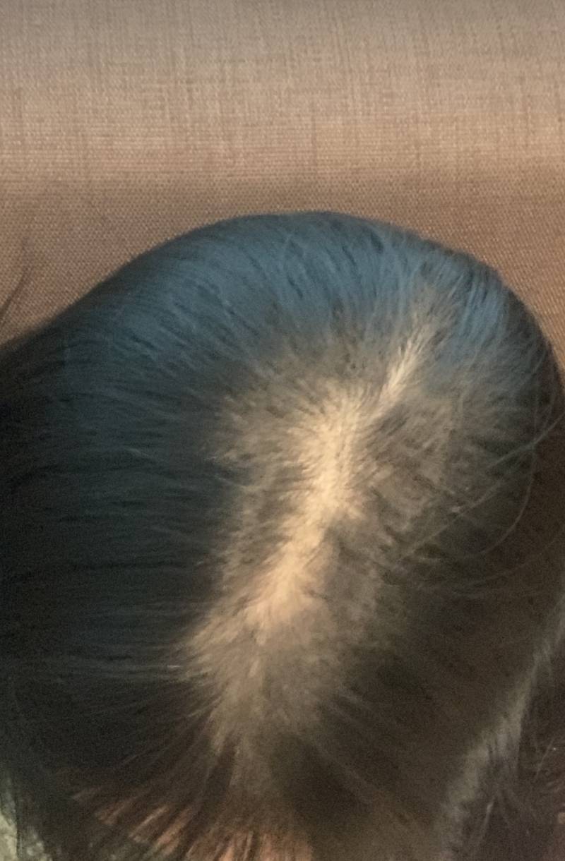 나 정수리 엄청 많이 비어보여...40 | 인스티즈