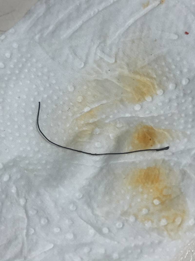 익들아 배달음식에서 이물질 나온거 ㅠㅠ | 인스티즈