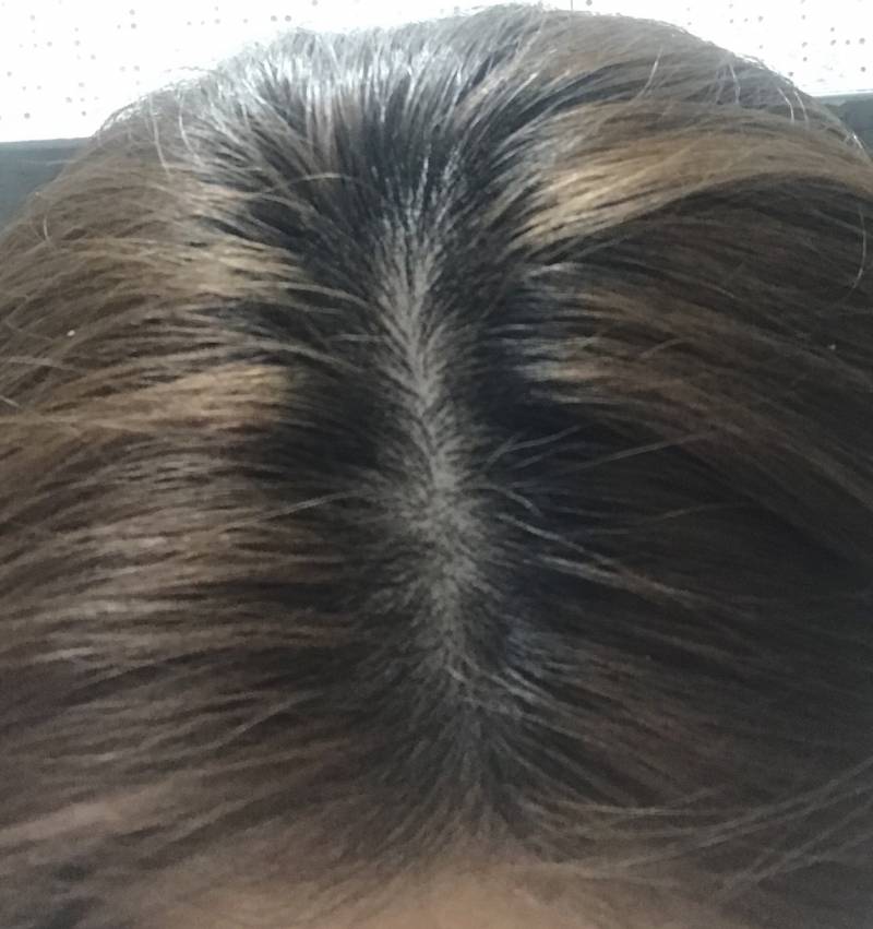 이정도면 뿌염 해야돼 ...? | 인스티즈