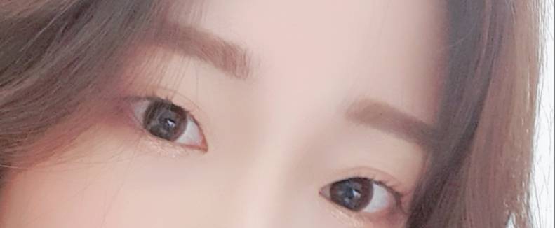 쌍수 전 후 40 (별거 없음 주의 | 인스티즈