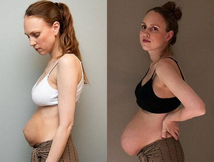 세쌍둥이 출산후라는데 | 인스티즈