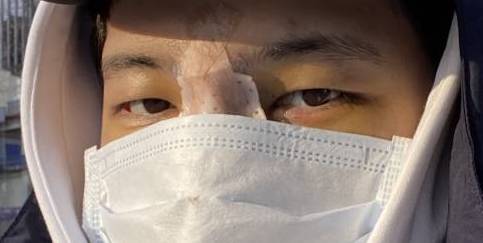 누가봐도 코수술한 사람이야? | 인스티즈