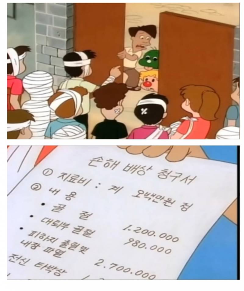 나 쌍수했는데 진짜 붓기가 너무 없어.. 펑 | 인스티즈