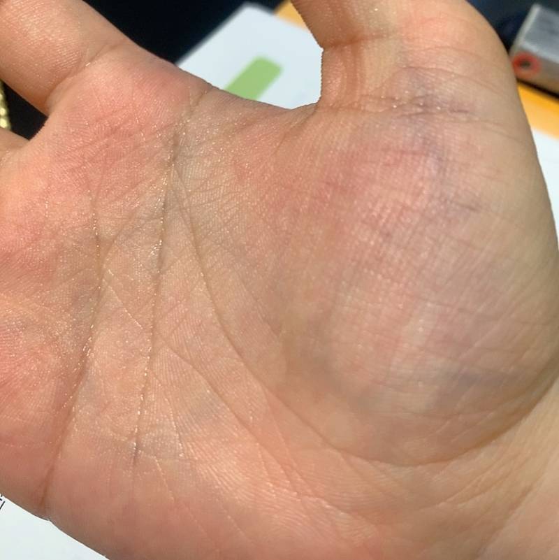 다한증 진짜 싫다 | 인스티즈