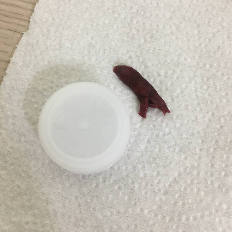 진짜 제발 여익들만 들어와줘 (혐오주의) | 인스티즈