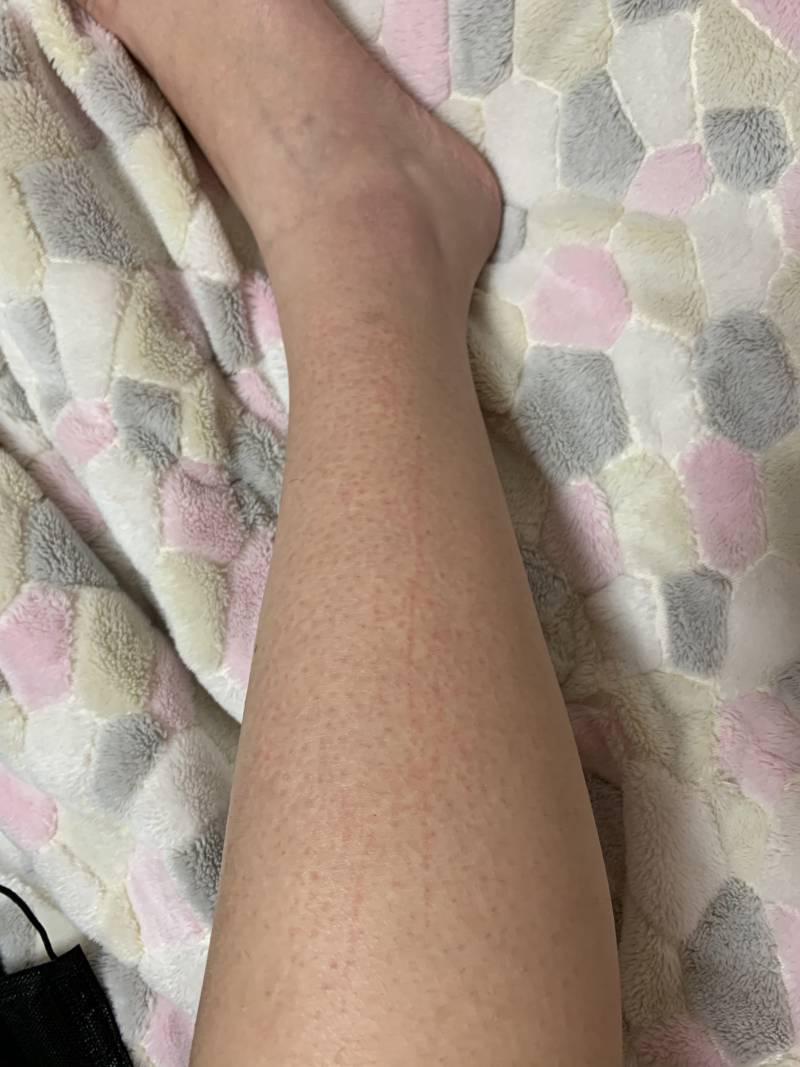 다리 면도 했는데 이거 베인거야....?(사진주의) | 인스티즈