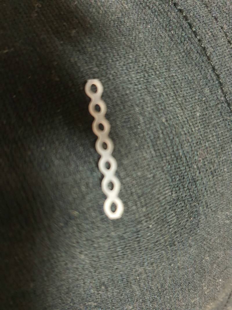 교정 이고무줄은 빼는거 아니야??? | 인스티즈