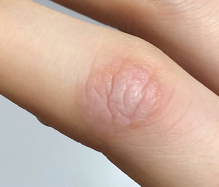 화상 입어본 사람 있어?ㅠㅠ 도와줘 | 인스티즈