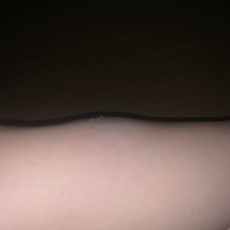 계단에서 굴렀는데 병원가야할까? | 인스티즈