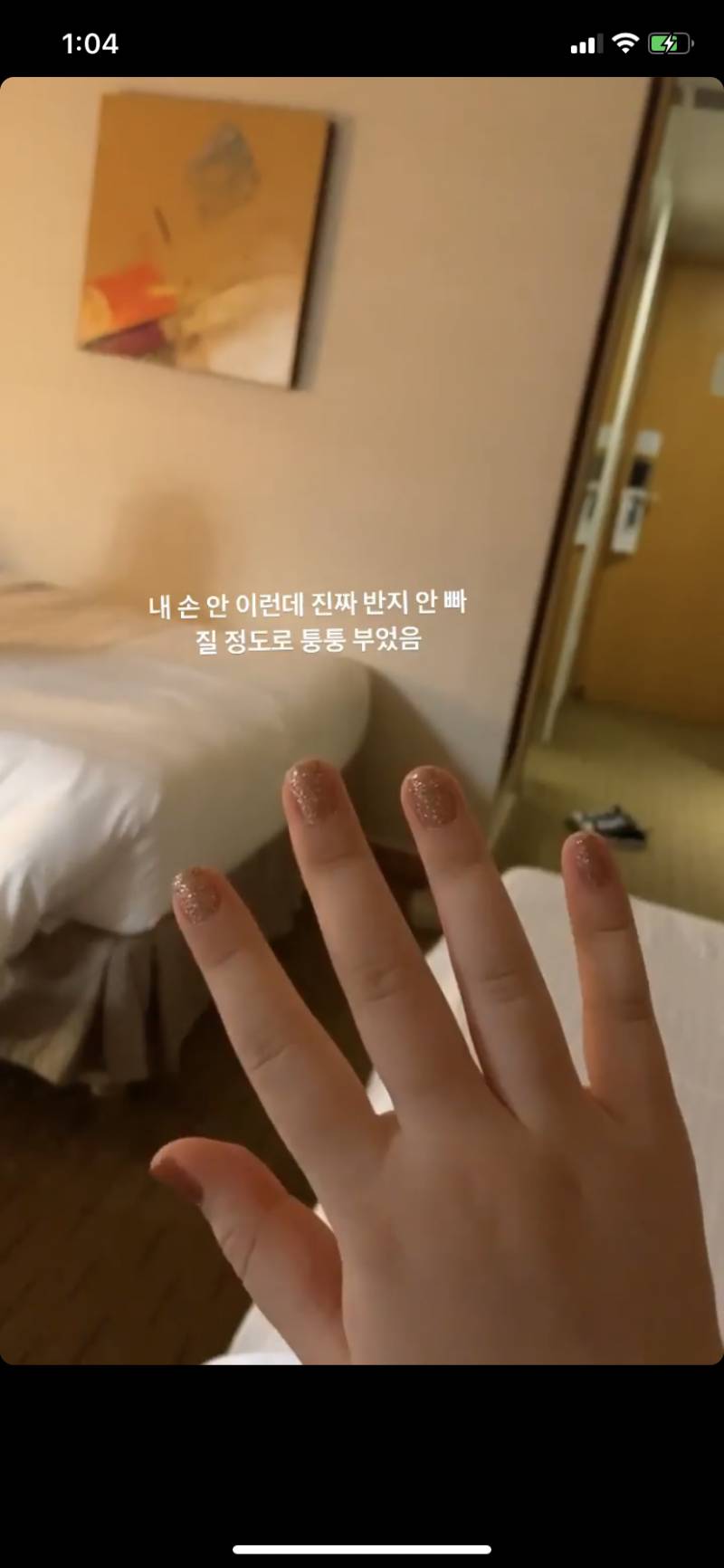 혹시 잘 붓는 익 있어?? | 인스티즈