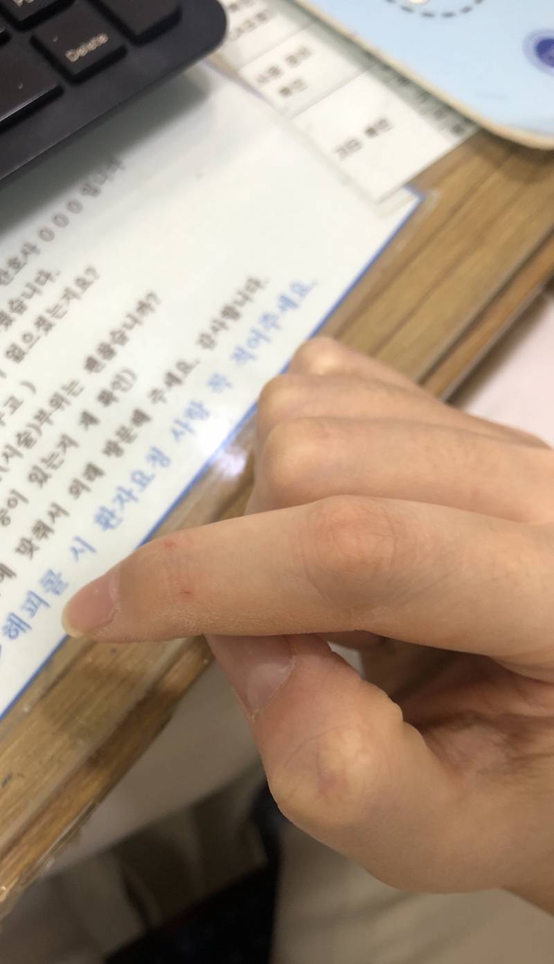 손 너무 씻어서 갈라져서 피나.. | 인스티즈