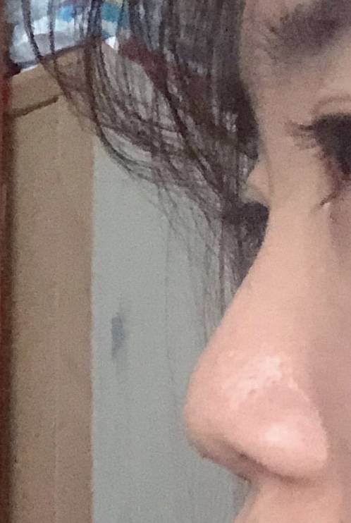 코수술 할까? | 인스티즈