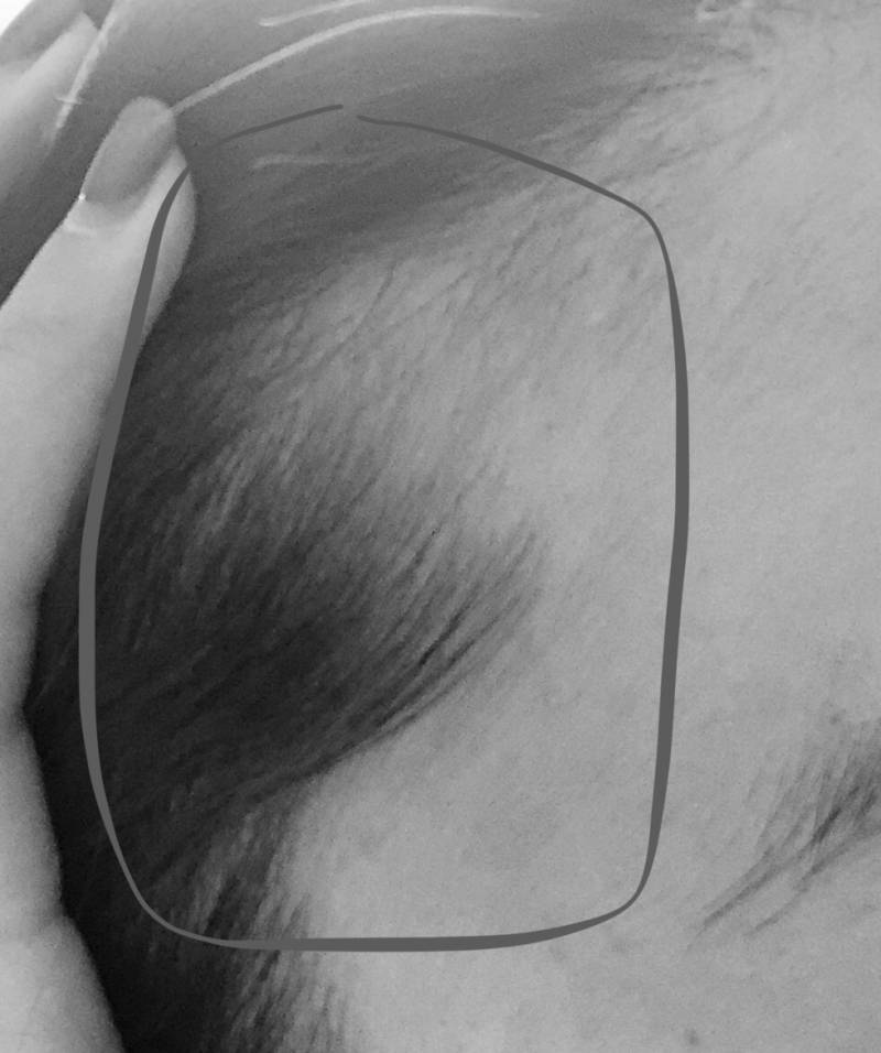 도움좀 ㅜㅜ나 머리 ..이거 뭐라고 하지 이거 진짜 스트레스ㅜㅜㅜ | 인스티즈