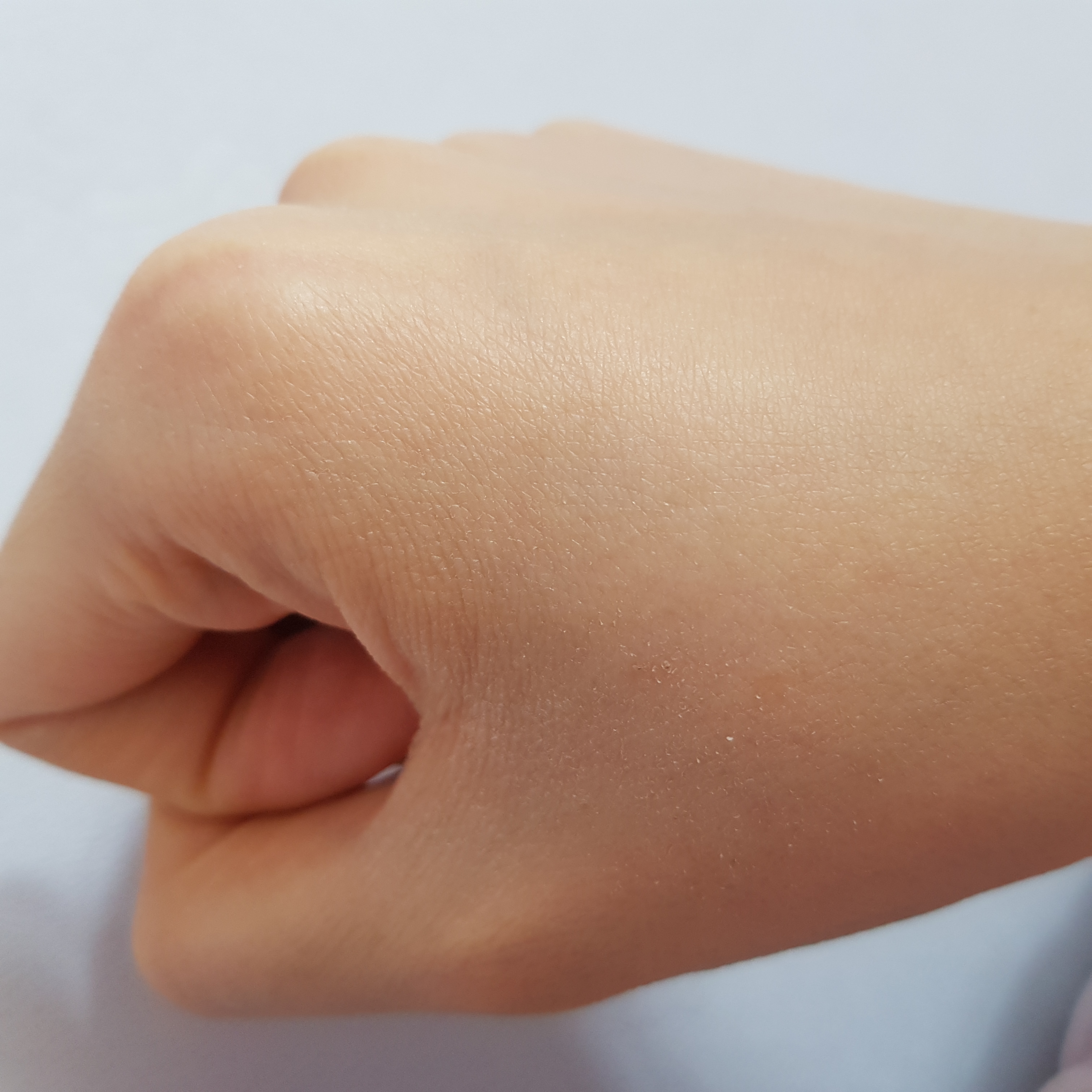 손소독제 쓰고 손 다 텄다... 40 | 인스티즈