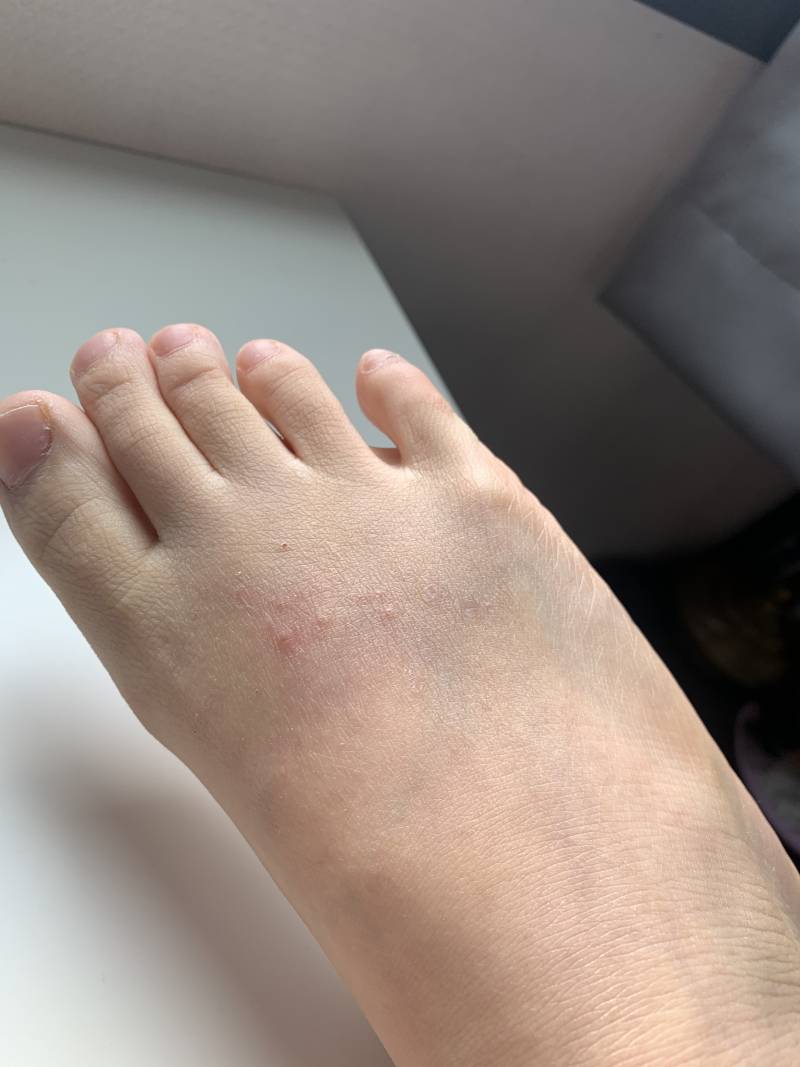 익들아 나 이거 피부과 가야할까 | 인스티즈