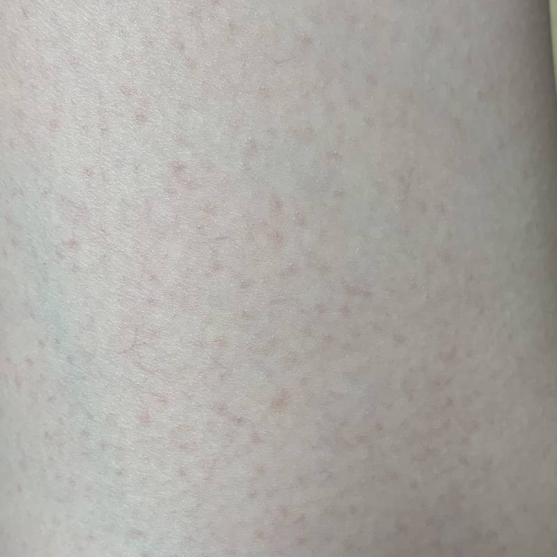 나 입욕제 썼는데 피부 왜 이런지 아는 사람 ㅠㅠ (ㅎㅇㅈㅇ) | 인스티즈