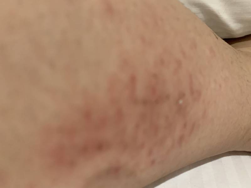 피부가 이상해 봐주라 추워서 그런거야? 40 | 인스티즈