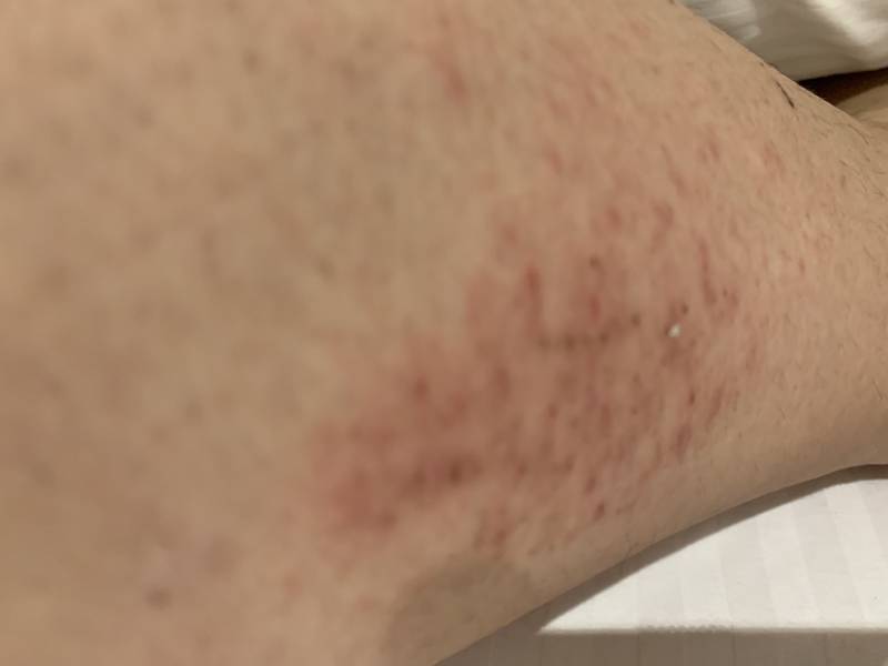 피부가 이상해 봐주라 추워서 그런거야? 40 | 인스티즈