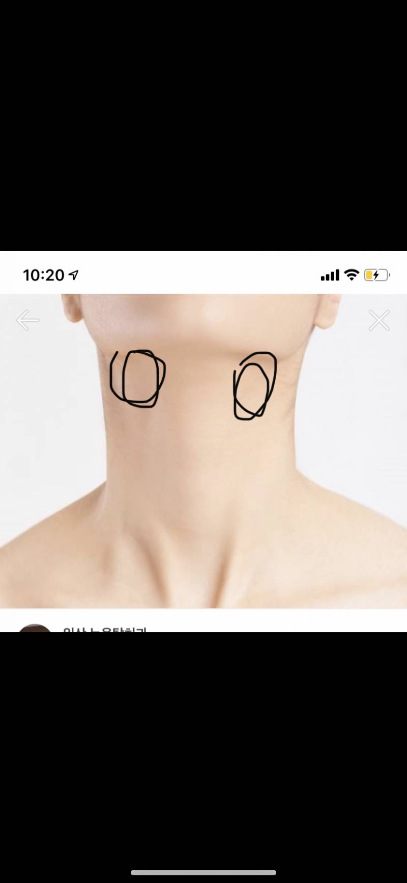 익들아 나 몸살감기 걸리면 목 이 두 부분이 몽울? 지거든?ㅠㅠ | 인스티즈