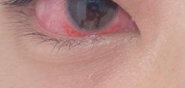 나 동공이 왜이러지ㅠㅠ (ㅎㅇㅈㅇ) | 인스티즈