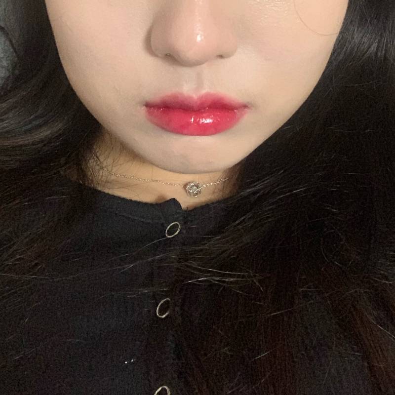 어제 얼굴지흡했는데 붓기있어도 전보다 빠진거깉지않아?? | 인스티즈