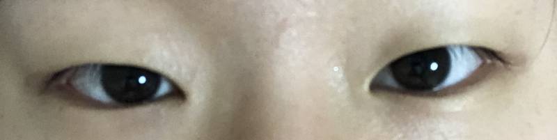 나 쌍수 할까말까ㅠㅠㅠㅠ | 인스티즈