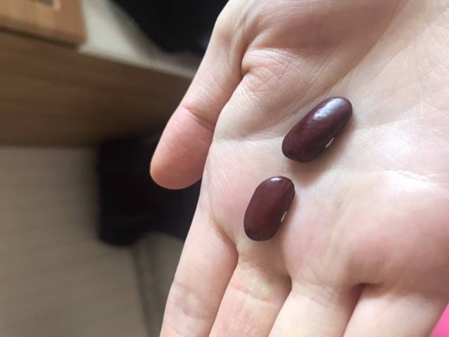 이거 뭔지 아는사람?? | 인스티즈