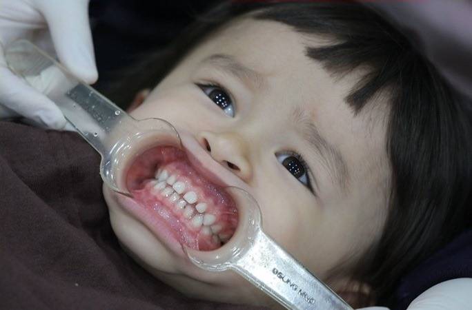 헐 윌리엄 이거 레전드다ㅋㅋㅋㅋ | 인스티즈