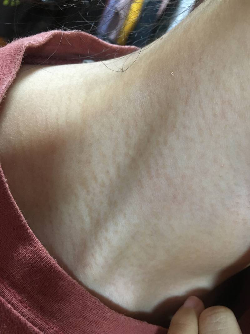 피부 왜이러는지 아는 익드류ㅠ🚨🚨 | 인스티즈