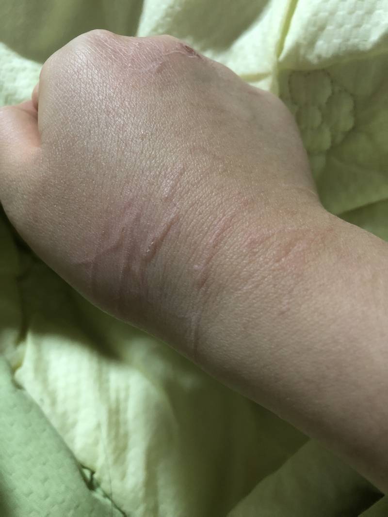 고양이 손톱 깎아줬는데 아파..ㅜㅜ | 인스티즈