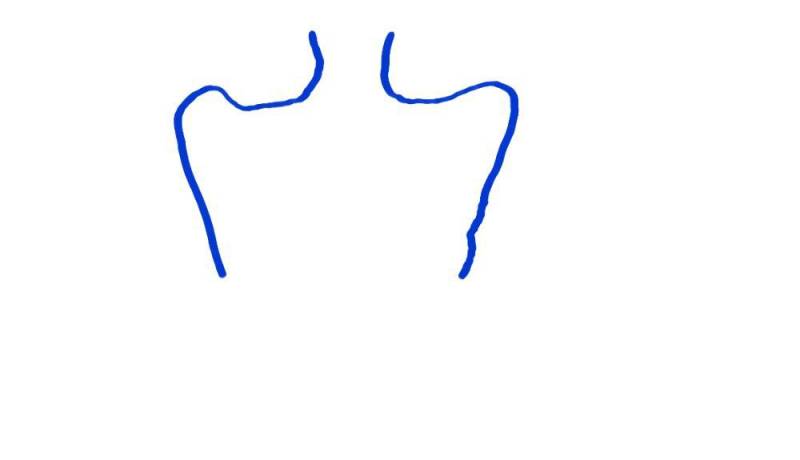 나 어깨가 이렇게 생겼는데 왜 이런거야??? | 인스티즈