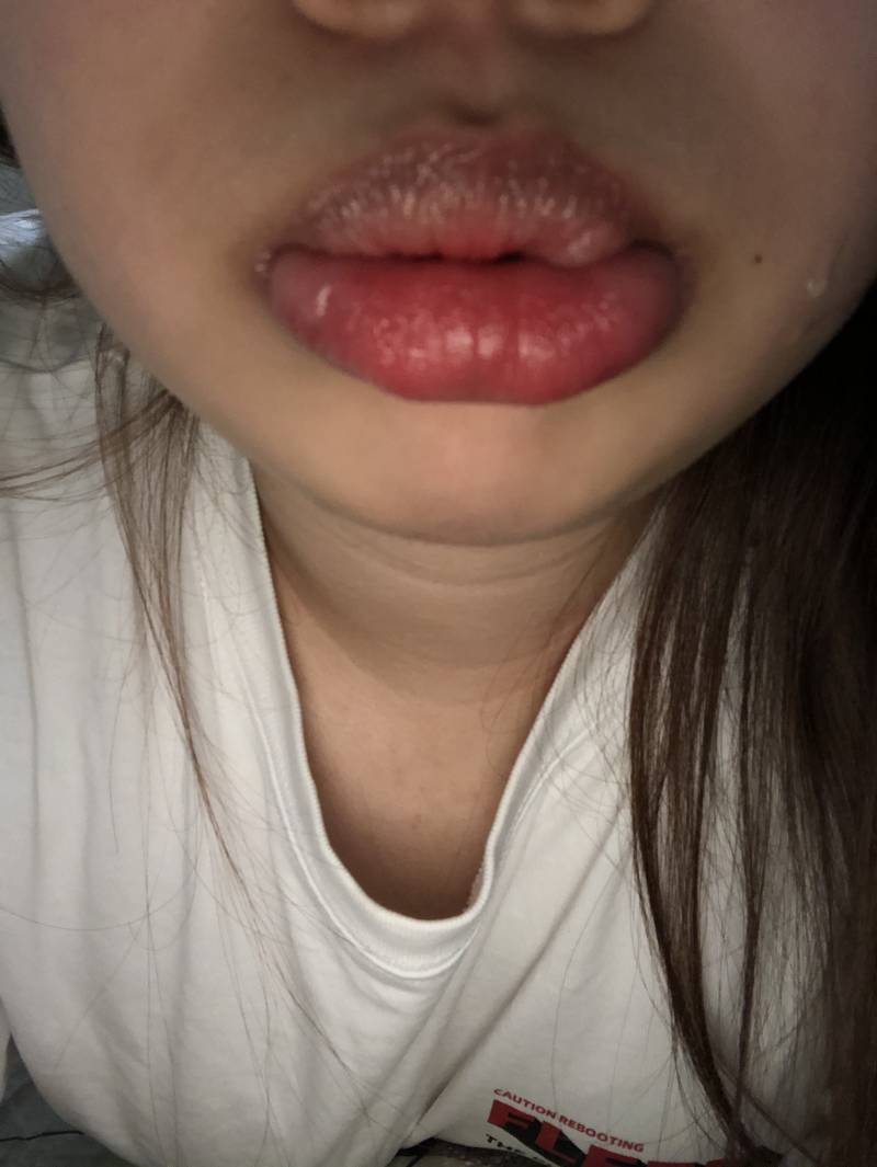 응급실 가야하는지 봐주라ㅠㅠ | 인스티즈