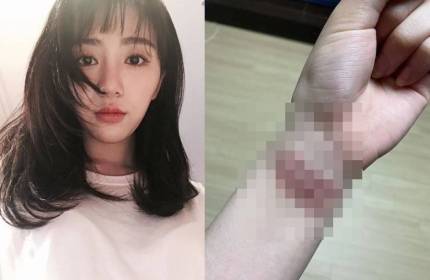 권민아, 손목 자해 사진 공개 "지민언니, 사과 해주라"[전문] | 인스티즈